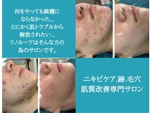 リノルーア(Linolua)