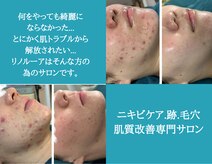 リノルーア(Linolua)