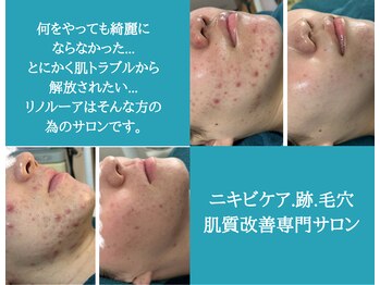 リノルーア(Linolua)