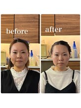 エメ 倉敷店(Aimer)/骨格補正ヘッドスパ 小顔矯正