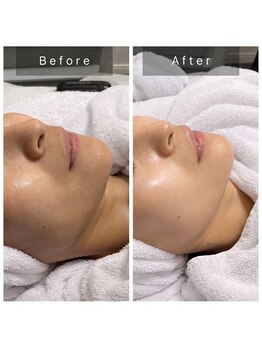 サロン ド パーフェクション(Salon de Perfection)/ブラックピール