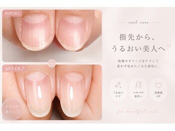ロッティ(Lottie)の写真/チビ爪・自爪の形・足の巻爪でお悩みの方★自爪ケアもお任せ下さい!“Lottie”で理想の美爪に導きます♪