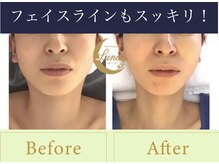 ルーナ(LUNA)/あなたに合った施術をご提供★