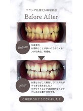 エクシアホワイト 平岸駅前店/