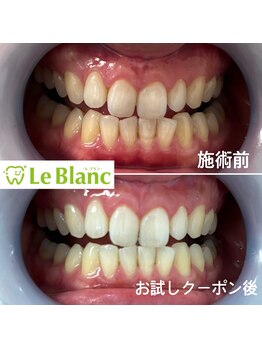 ルブラン 奈良店(Le Blanc)/15分3回！お得なクーポン！