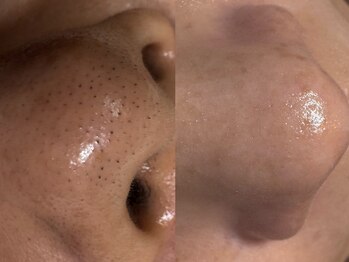 サラグランデ(Sara Grande)/美鼻(美肌)は最高のジュエリー