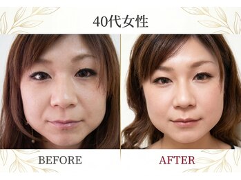 Nine9【ナイン】/ビフォーアフター例 1