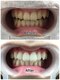 ドクターモック(Dr.MOC)の写真/【高品質ジェル使用で理想の白さ◎】歯科提携だから満足度の高い実感!歯が白くなると肌も白く見えるかも!?