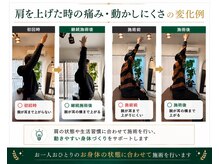 オルカ整体院(ORCA整体院)の雰囲気(肩の痛みなら当院にお任せください!)
