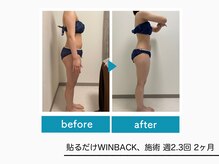 ハピネスビューティーサロン(happiness beauty salon)/WINBACK症例