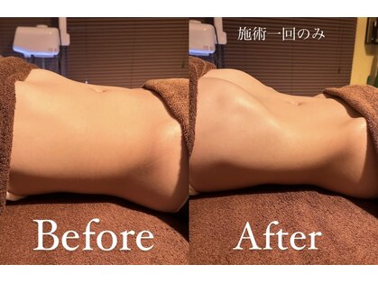 ヨロ(YOLO)の写真