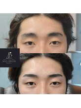 アンドブロウ 前橋(AND BROW)/自己処理からの解放