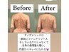 【3名様限定】究極の小顔&美骨矯正でトータル美骨メソッド◎2回コース残2名様