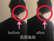 ツバキ(TUBAKI)/痛みスッキリ！根本解決筋膜施術