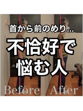 カワル整体 上通り院/姿勢が不恰好な人