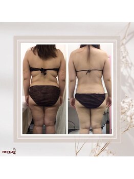 効くラボ 梅田店/月4回来店！ブライダルエステ★