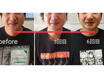 エム(M)/小顔矯正 整体