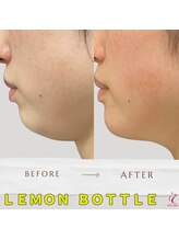 ラディアント 吉祥寺/気になる顎下もすっきり