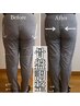 【人気No.３】女性限定☆骨盤矯正≪産後・家事育児・仕事≫￥7700→￥4700