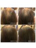 NEW！【体毛は増やさず髪だけ育てる自然派ケア】40分本気育毛体験♪￥8800→