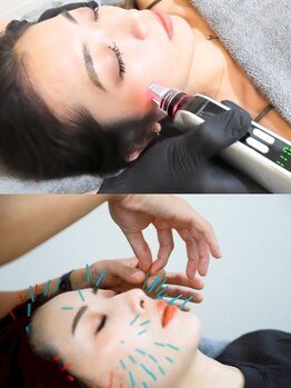 鍼灸施術を受けたい