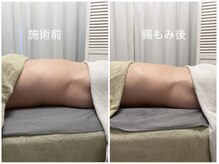 カナロア(Kanaloa)/HOT腸もみ★痩身/マッサージ