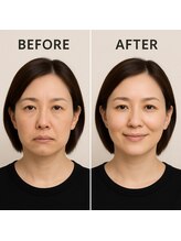 大門鍼灸整骨院/美容鍼　ご新規様３９８０円！