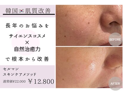 アンベリール(embellir.)の写真