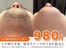 メンズ脱毛サロン ボス(BOSS)の雰囲気（ヒゲ脱毛10回のお写真 #メンズ脱毛#ヒゲ脱毛#VIO#眉毛#全身脱毛）