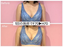 ククナ 新潟本店(KUKUNA)/＊バストアップケア＊