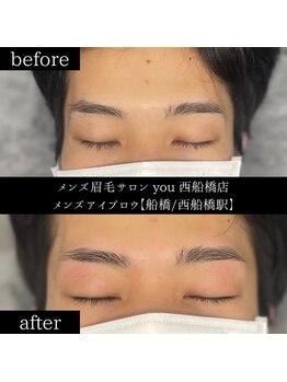 ユー 西船橋店(you)/ビフォーアフター写真