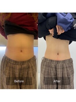 キレピア 熊本インター店(kirepia)/1ヶ月でマイナス15センチ!!