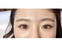 アミアイレ 本町(amiaire)/