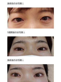 アロマスイーツ(AromaSweets)/まつげパーマ/まつ毛パーマ