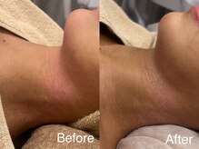 シェリーミル(Cherie Miru)/赤みケア・鎮静・保湿