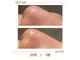 ユジュ(yju)の写真