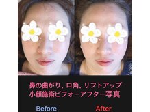 美容矯正サロン レレポノ(LELEPONO)/