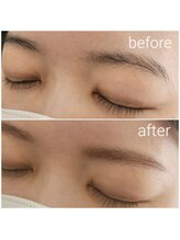 ビメ 中央林間(BEME)/before・after