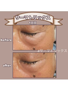 ビーマジック(美magic)/サーマトリックス