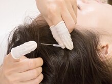 頭痛や眼精疲労をもたらしやすい側頭筋のコリも的確にアプローチ