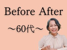 おがわ整骨院/60代ダイエット実績