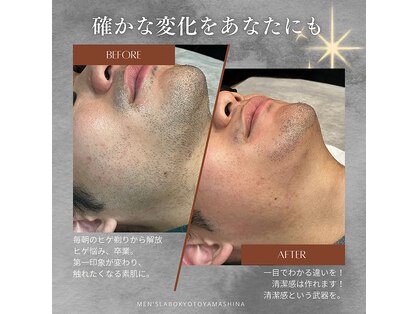 メンズラボ 京都山科店の写真