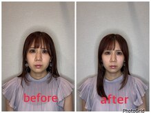 小林整骨院 本町/【顔がまるっと小さく◎】