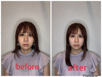 小林整骨院 本町/【顔がまるっと小さく◎】