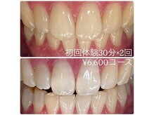 ホワイトニングルーム 横浜店(Whitening Room)/セルフホワイトニング/横浜