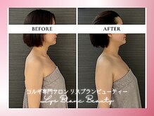 リスブランビューティー(Lys Blanc Beauty)/９０分コルギBefore×After