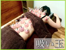 あらき鍼灸整体院/吸い玉(カッピング)