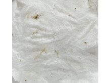 オウカ(OUKA)/毛穴汚れがごっそり！