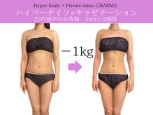 シャルム(charme)/ハイパーナイフで結果出し！痩身