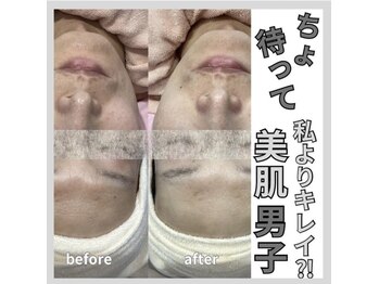 じゅえる/メンズエステの効果ホントすごい